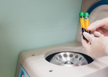 04. PRP and CGF Kits